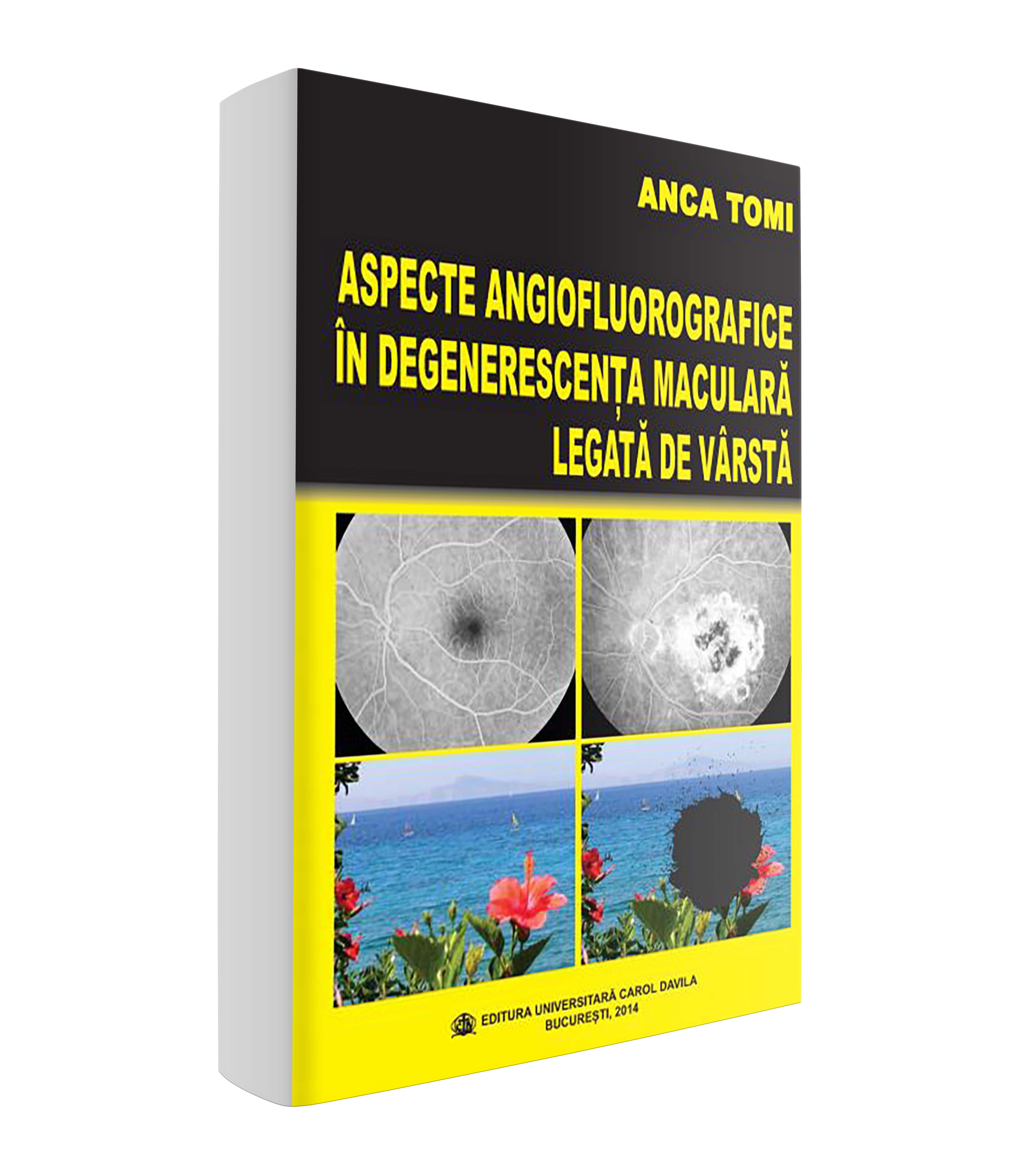 <p>Aspecte angiofluorografice în degenerescenţa maculară legată de vârstă</p>
