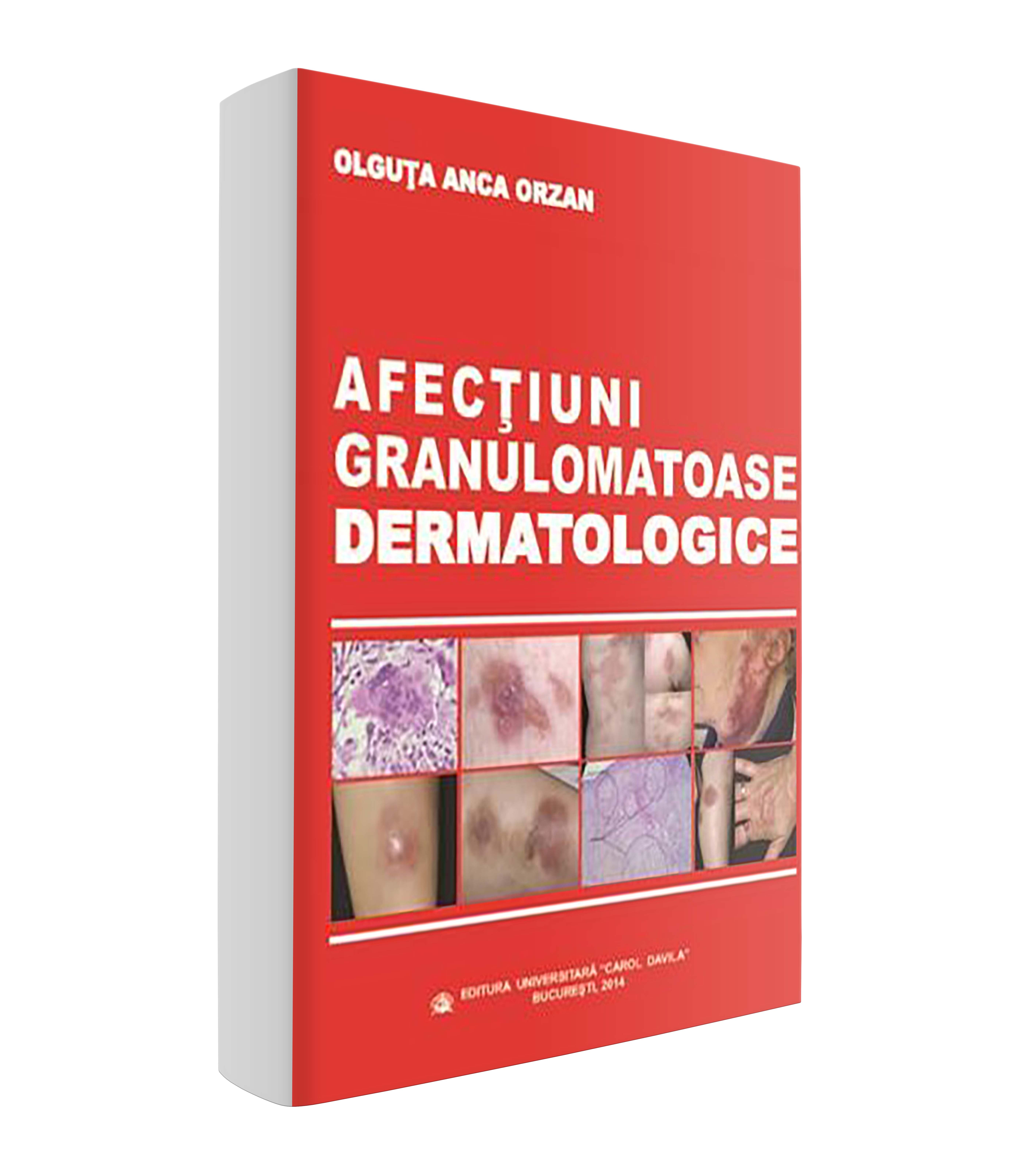 <p>Afecțiuni granulomatoase dermatologice</p>