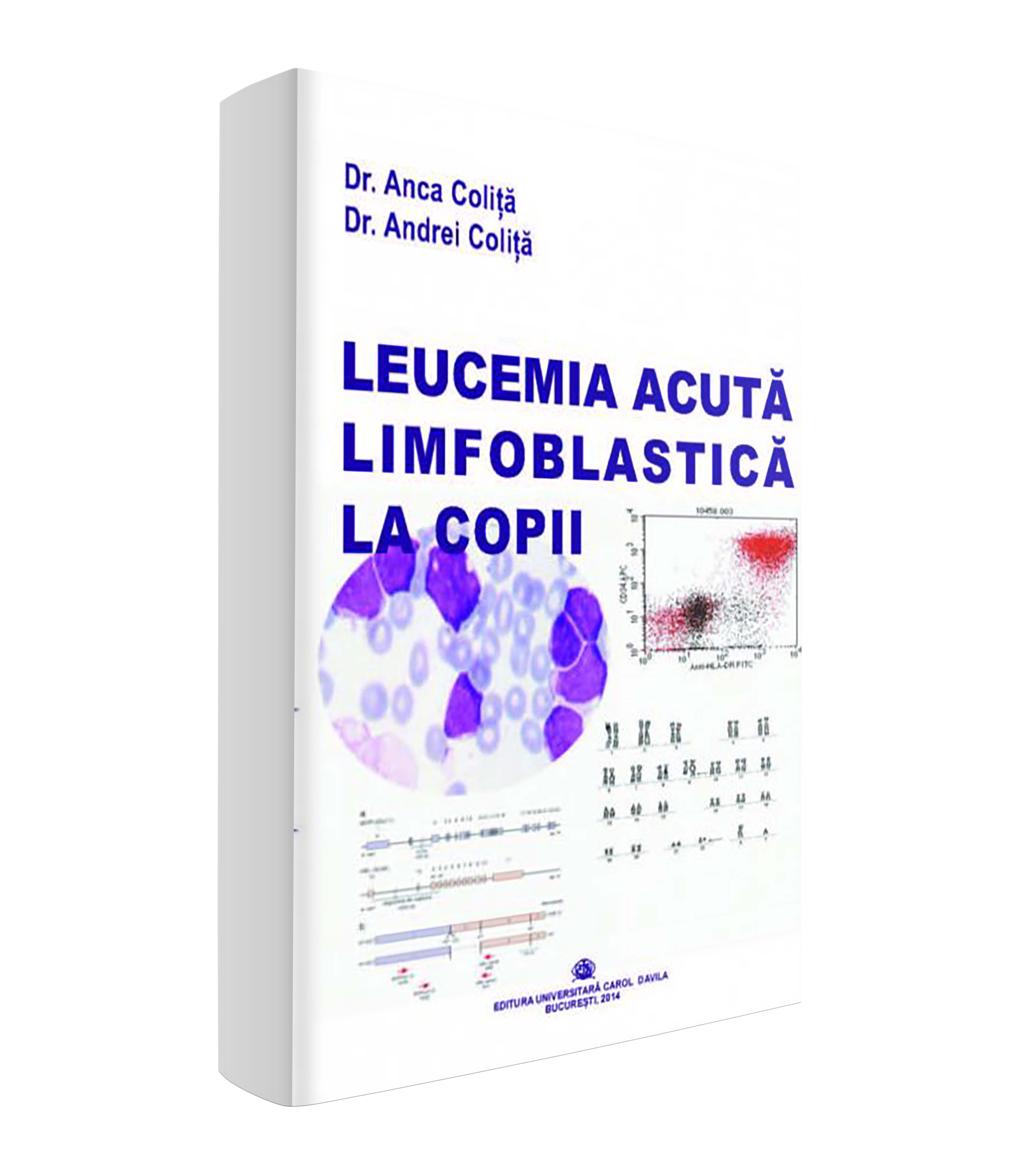 <p>Leucemia acută limfoblastică la copii</p>