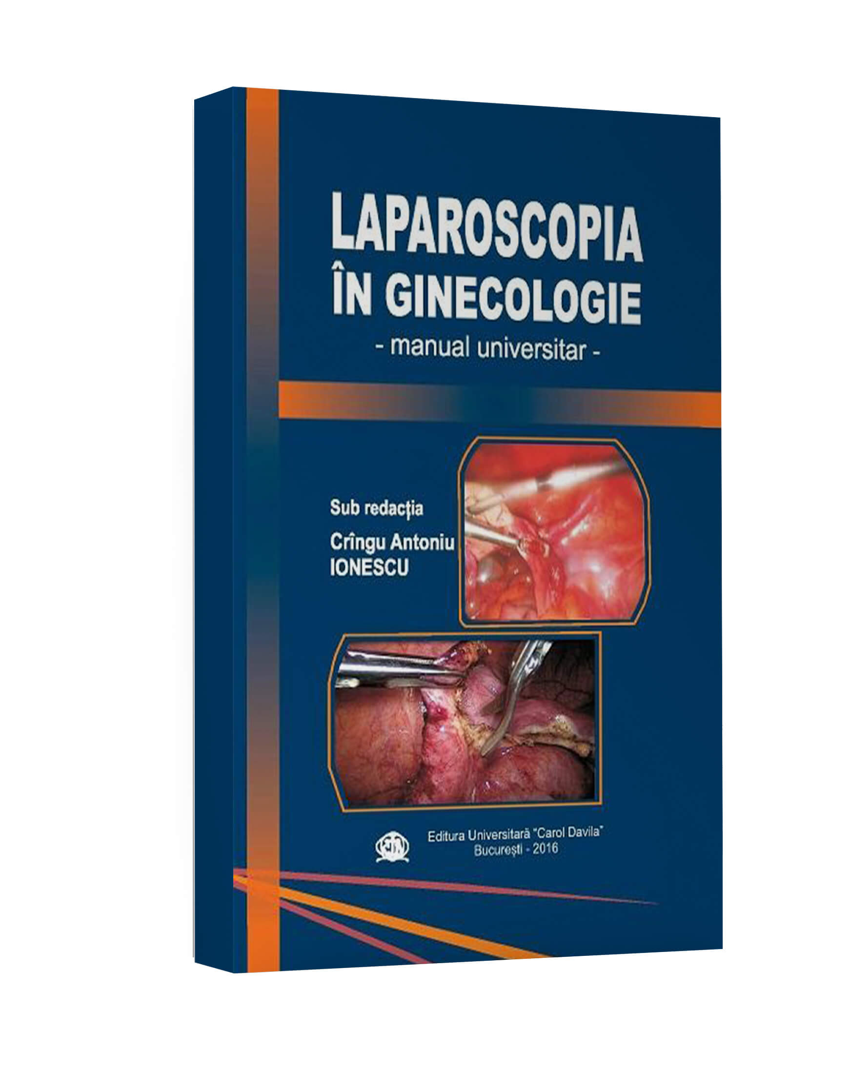 <p>Laparoscopia în ginecologie</p> -Manual universitar-</p>